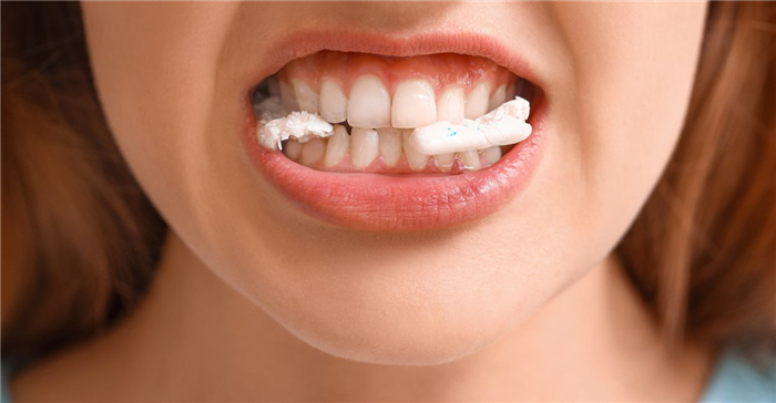 Sueño de chicle atascado en los dientes - 10 tipos y sus interpretaciones